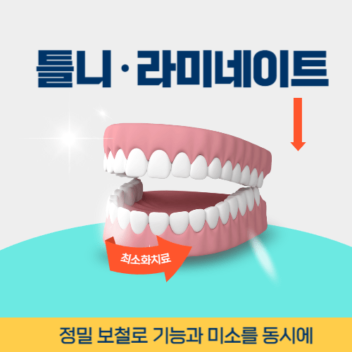 공주치과 공주시 치과 틀니 라미네이트