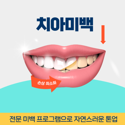 공주치과 공주시 치과 치아미백