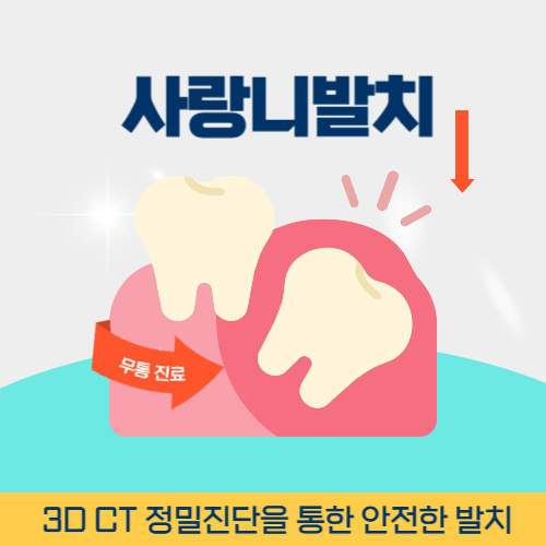 공주치과 공주시 치과 사랑니 발치