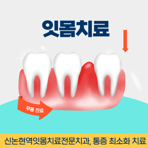 공주치과 공주시 치과 잇몸치료